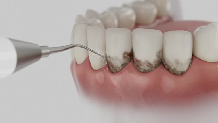 Trusted Tooth Extraction service in Melcher-Dallas, IA - Dentist Open Now